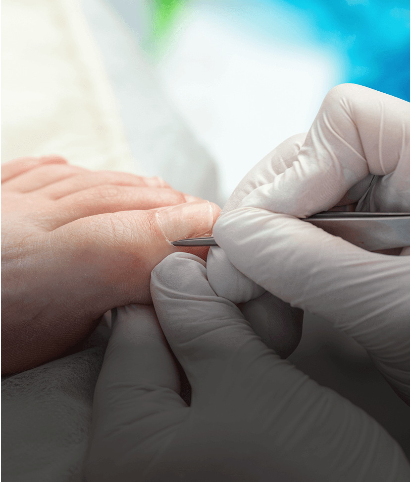 Foot care procedure with gloved hands and tool.