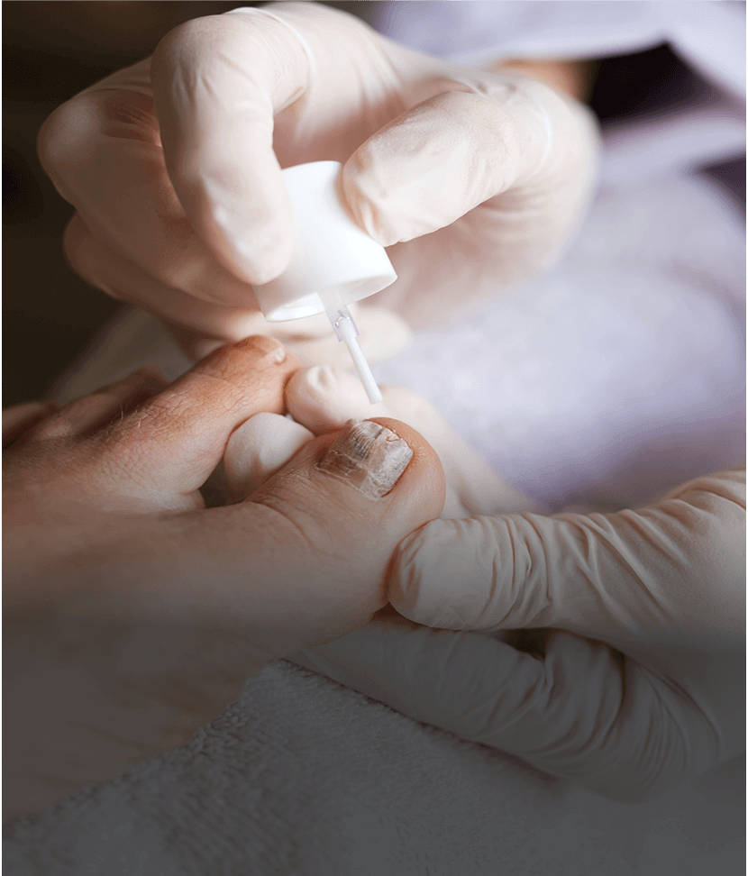 Applying nail polish to toenails, close-up.