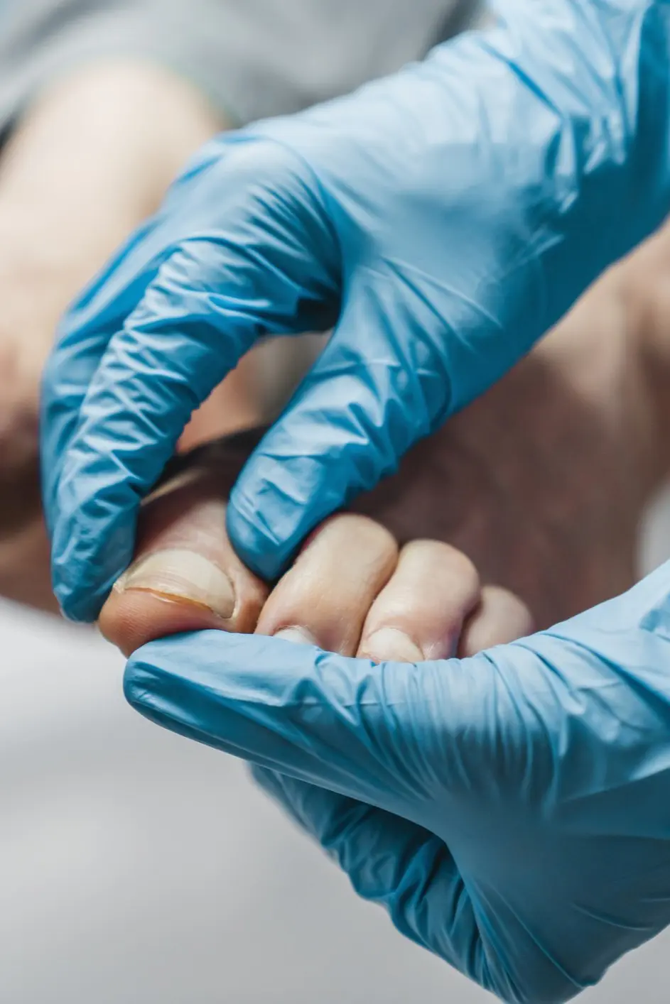 Gloved hands examining a person's toenails.