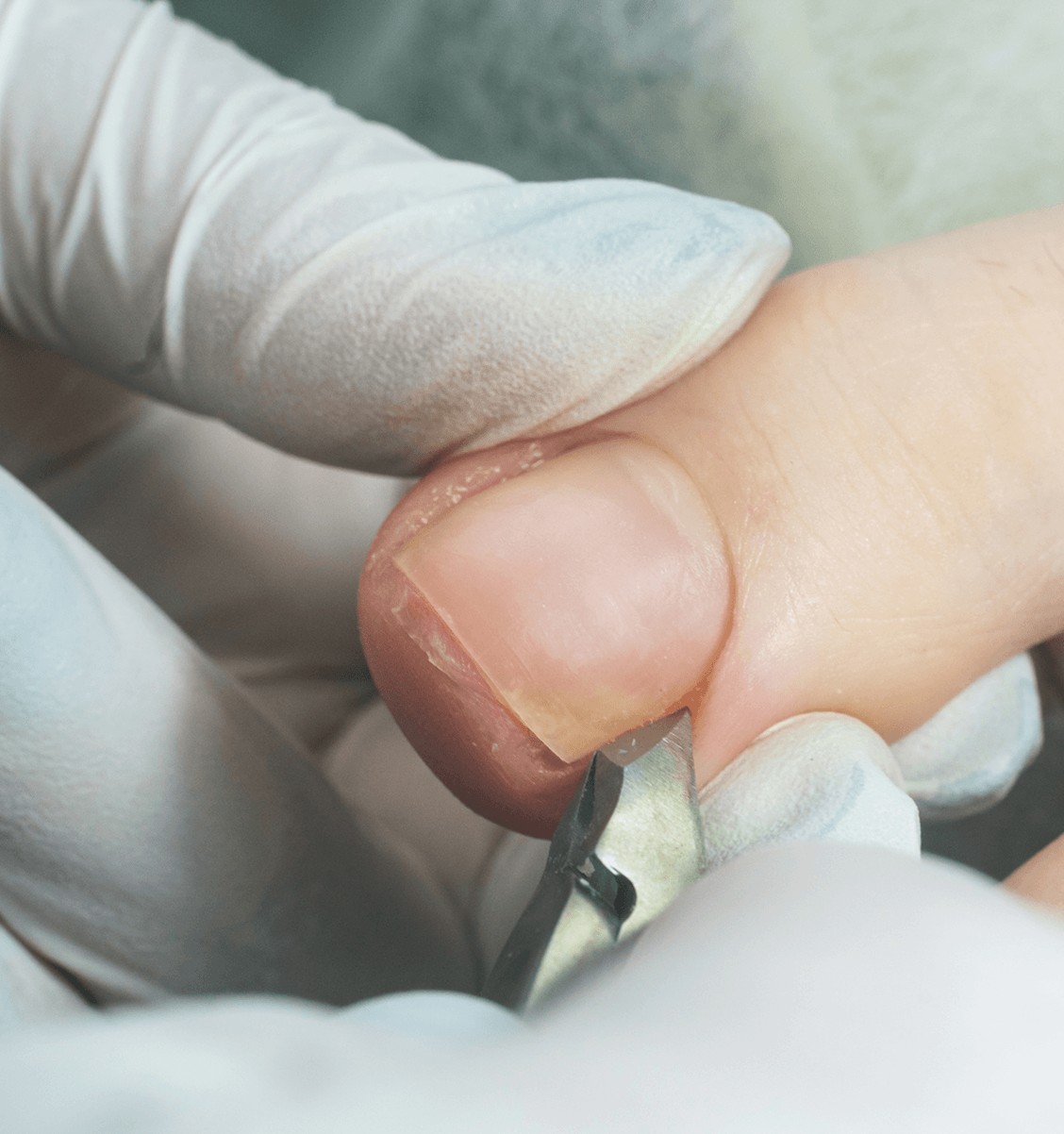 Cutting fingernail with clippers and gloves.